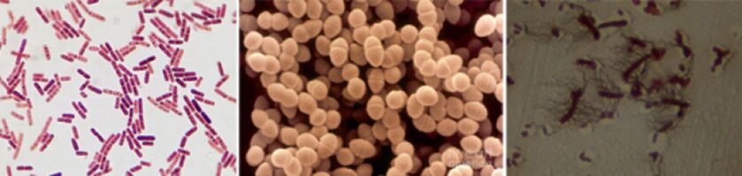Escherichia coli, enterococos fecais e Proteus são os principais agentes causadores da prostatite bacteriana crônica