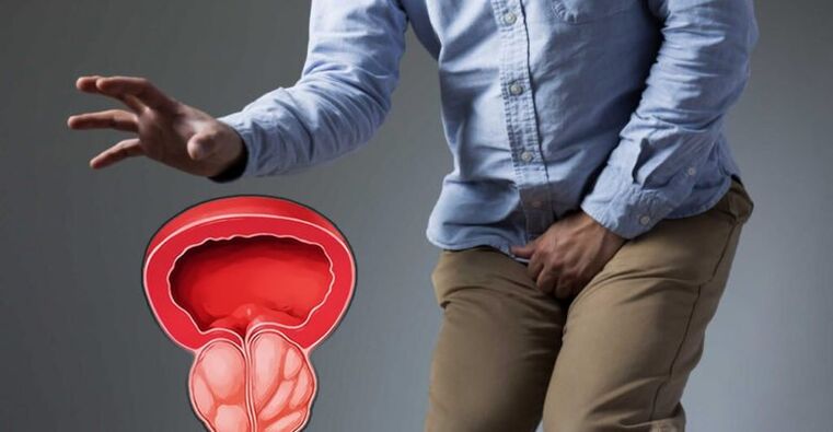 Prevenção de prostatite e adenoma da próstata